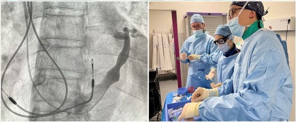 cardiologie interventionnelle (2)